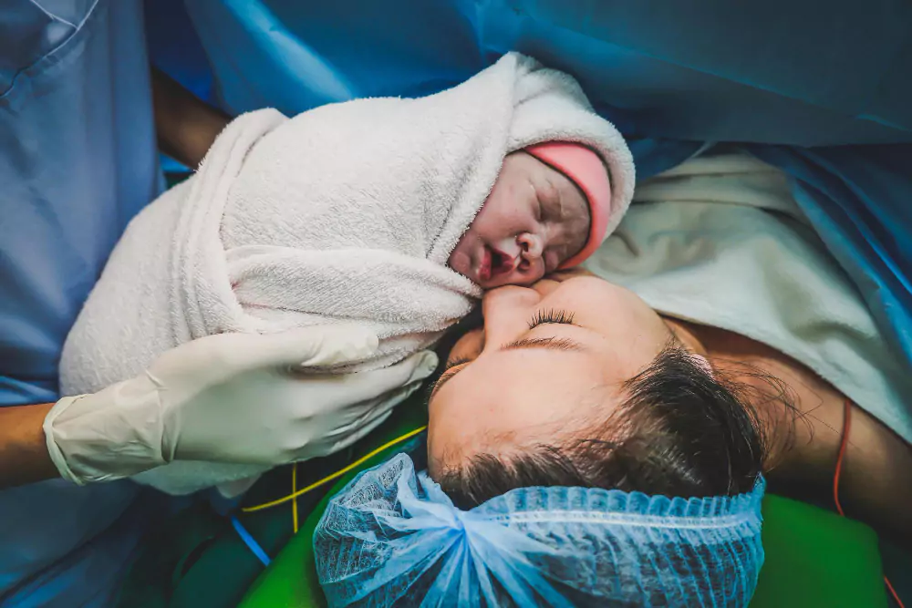 Cesarean Delivery